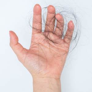 Tipps gegen Haarausfall